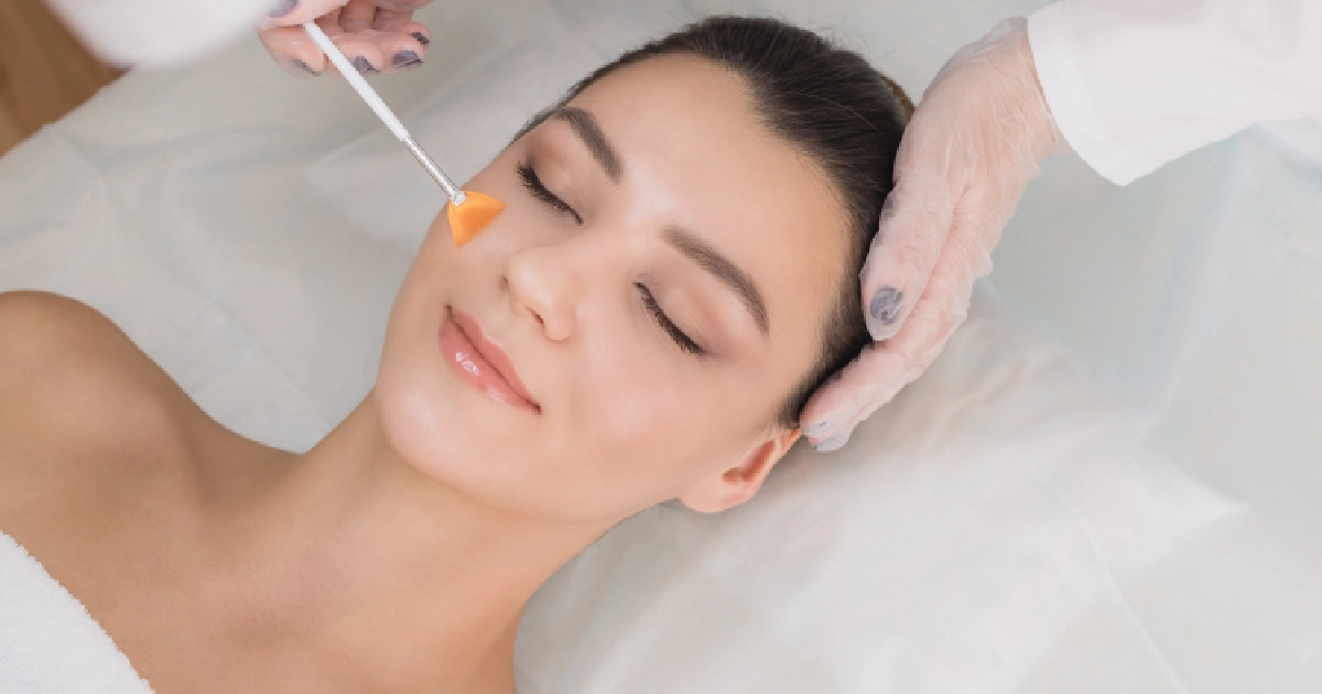 Chemical Peel by True Bella Medical Aesthetics in Downey, CA